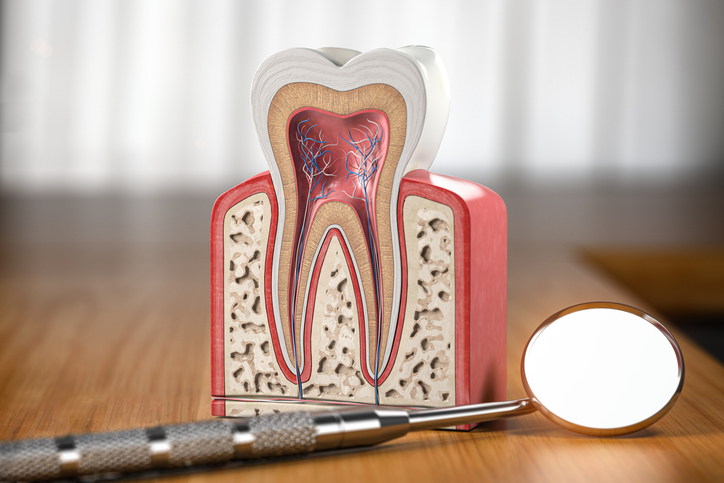 Root Canal