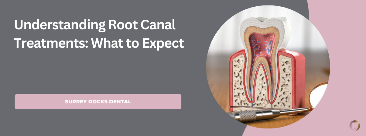 Root Canal 