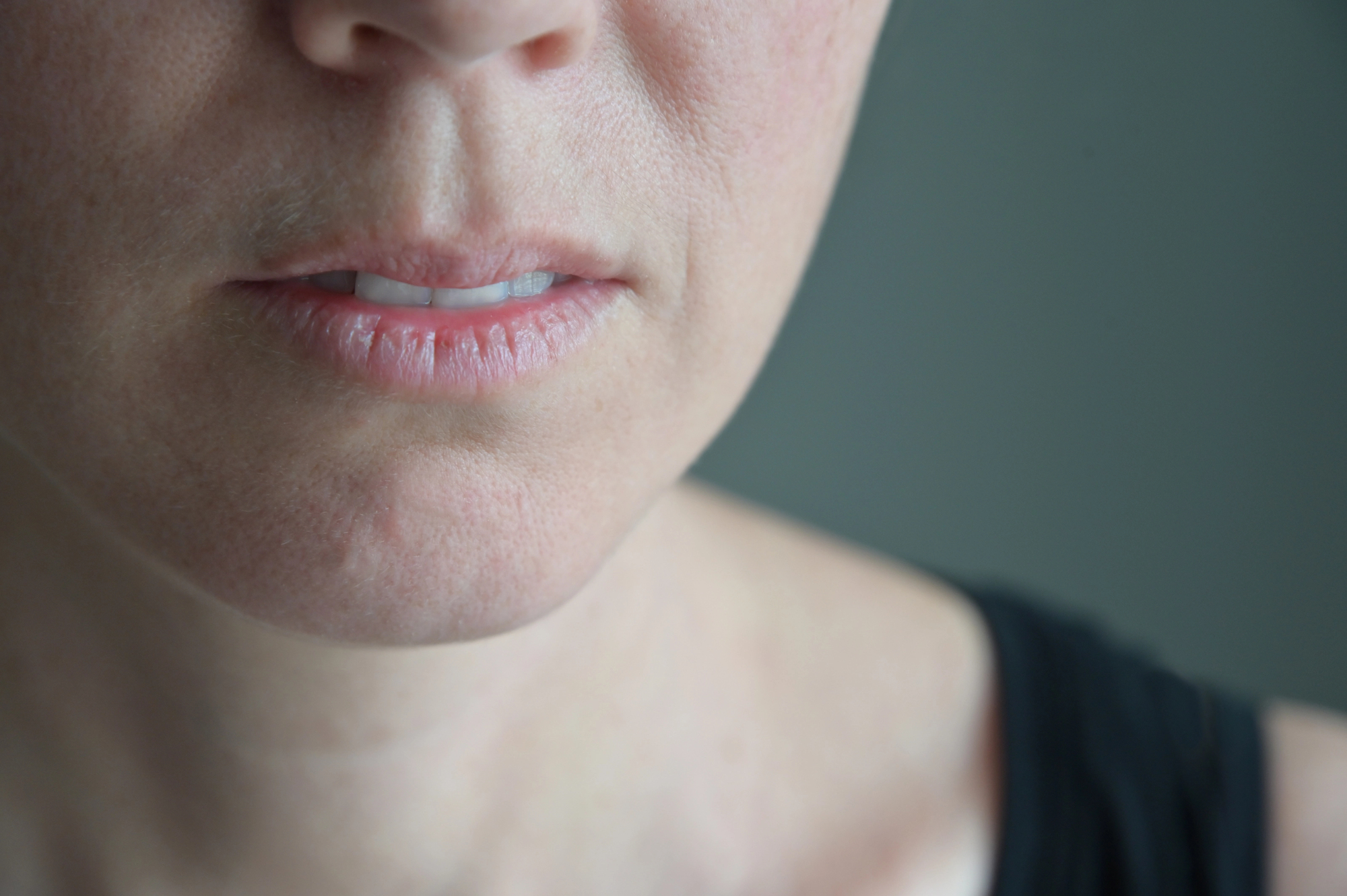 Woman with dry mouth and lips