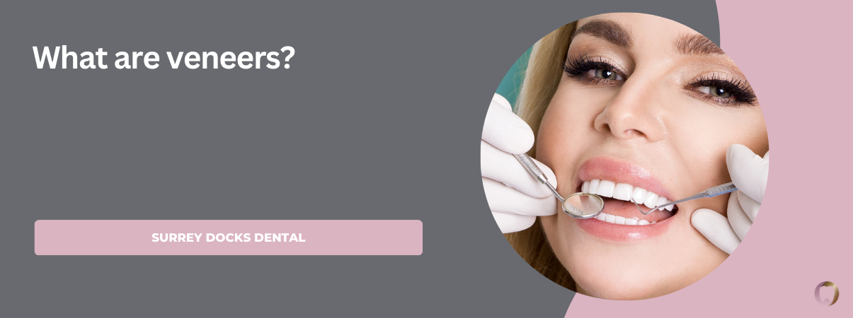What are veneers