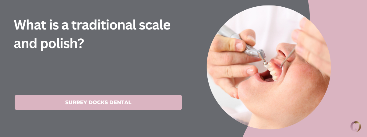 What is a traditional scale and polish?