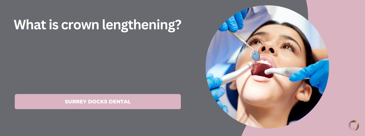 What is crown lengthening?